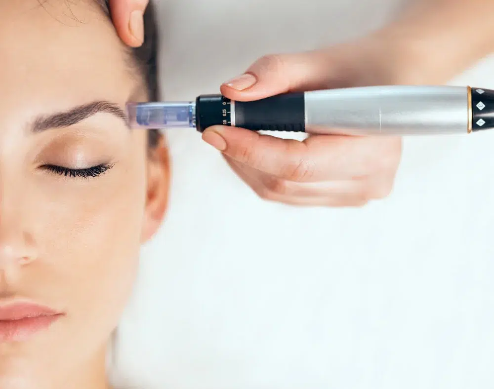 Mesotherapy-Face-Hair01